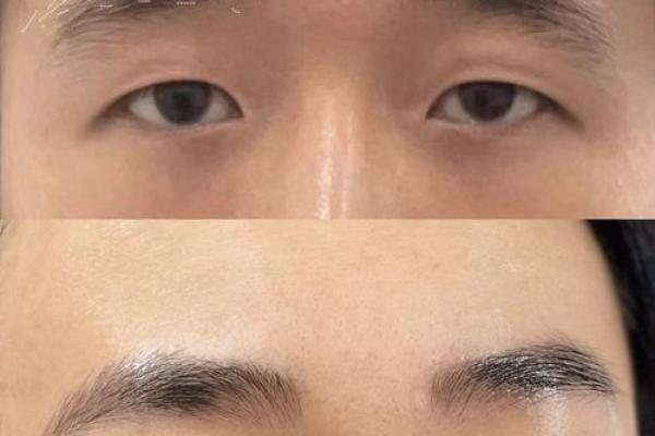 八字眉男人能嫁吗