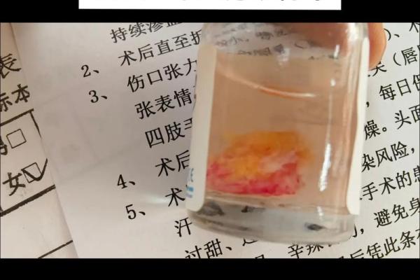 背上的痣图解算命
